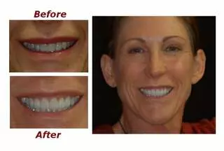 Artisan Dental