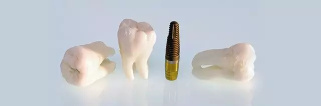 All Valley Dental