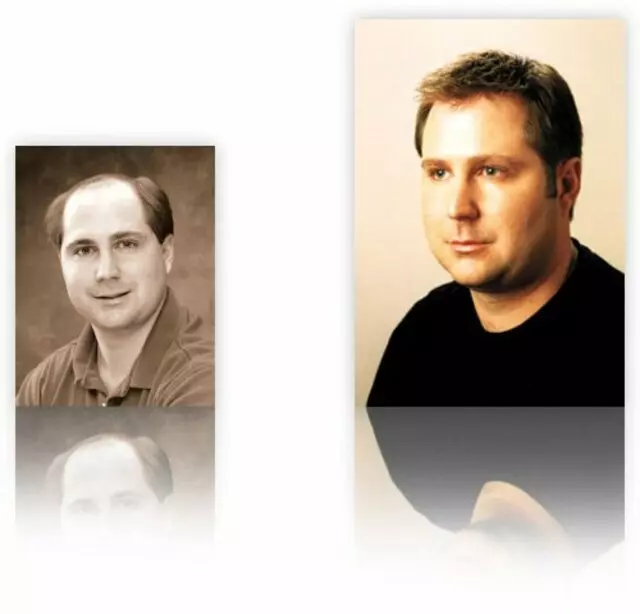 Apollo Hair Systems