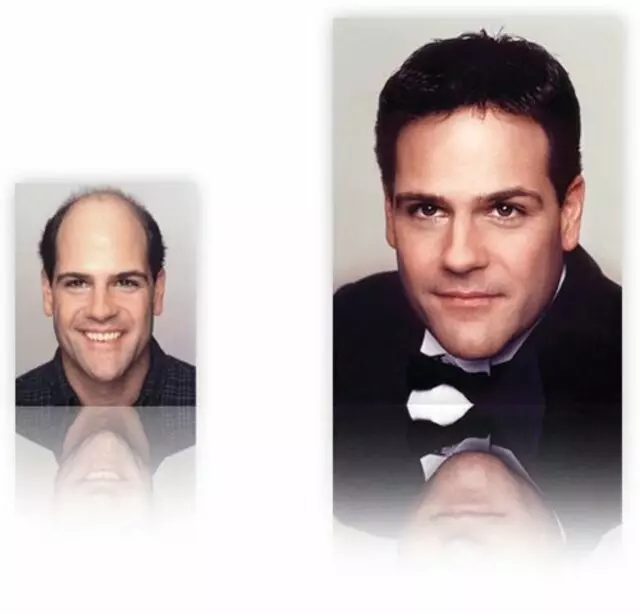 Apollo Hair Systems