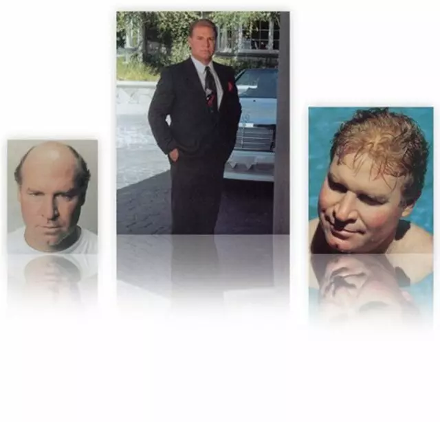Apollo Hair Systems
