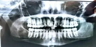 David J Smoot - Smoot Center for Oral and Maxillofacial Surgery