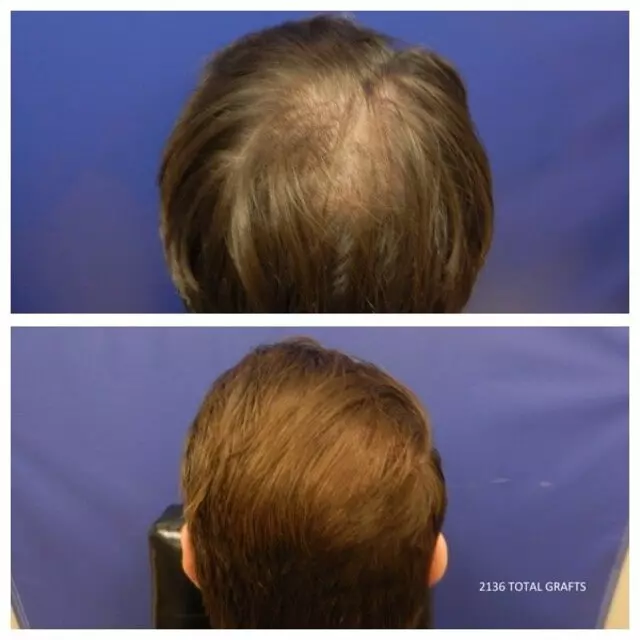 Advanced Medical Hair Institute