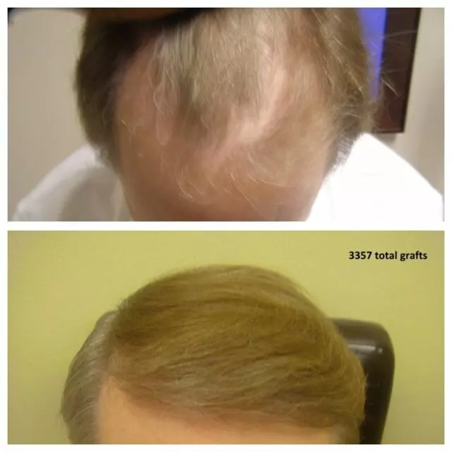 Advanced Medical Hair Institute
