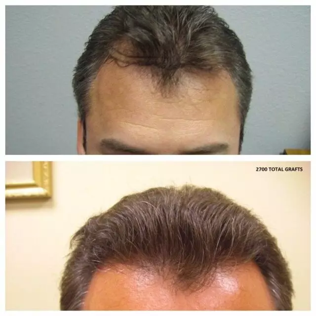 Advanced Medical Hair Institute