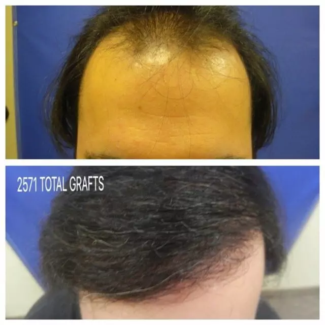 Advanced Medical Hair Institute